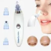 Battery-Operated Blackhead Removal Machine | 4-in-1 Blackhead Remover