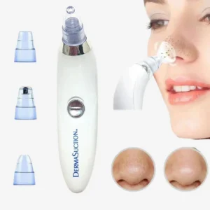 Battery-Operated Blackhead Removal Machine | 4-in-1 Blackhead Remover