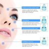 Battery-Operated Blackhead Removal Machine | 4-in-1 Blackhead Remover