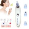 Battery-Operated Blackhead Removal Machine | 4-in-1 Blackhead Remover