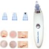 Battery-Operated Blackhead Removal Machine | 4-in-1 Blackhead Remover