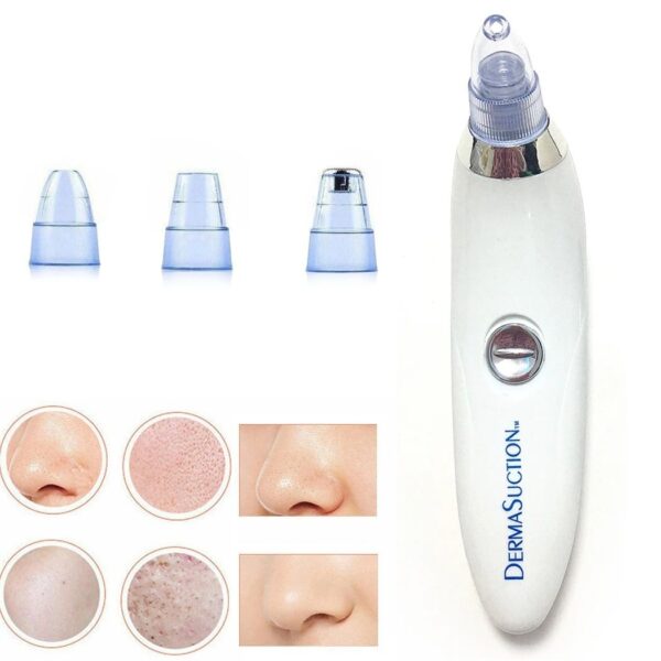 Battery-Operated Blackhead Removal Machine | 4-in-1 Blackhead Remover