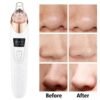 Upgraded Blackhead Remover Vacuum | Electric Facial Pore Cleaner