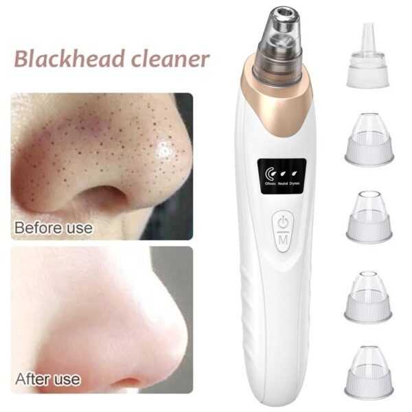 Upgraded Blackhead Remover Vacuum | Electric Facial Pore Cleaner